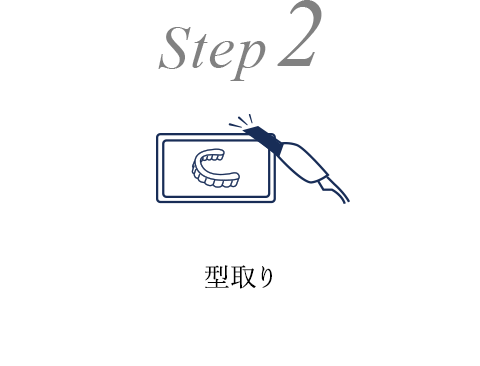 Step2 型取り