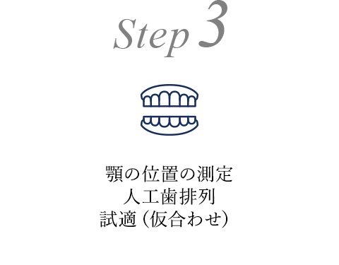 Step3 顎の位置の測定 人工歯配列 試適（仮合わせ）