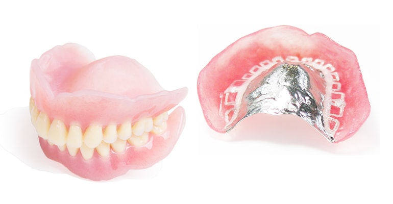 総義歯（総入れ歯）の治療